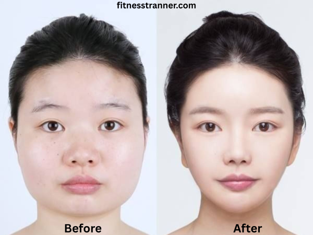 How to reduce face fat