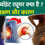 Hip Joint Tumor के लक्षण और हड्डी में ट्यूमर का चित्र